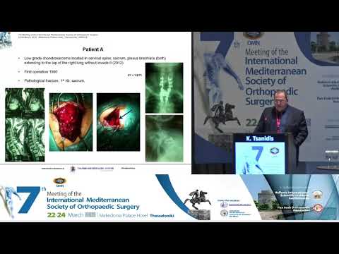 Tsanidis K - Orthopaedic oncology surgery: Is there an end in surgical treatment?