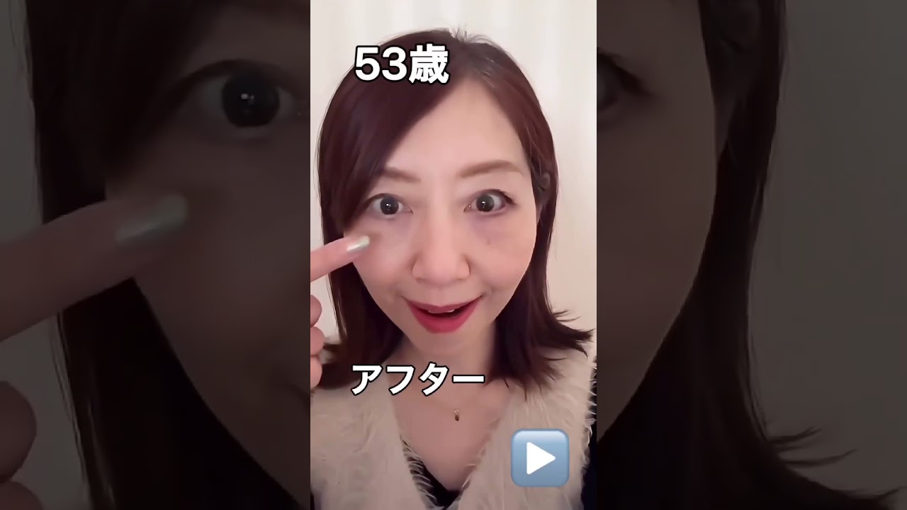【目の下のたるみ47歳ビフォー▶️53歳アフター】