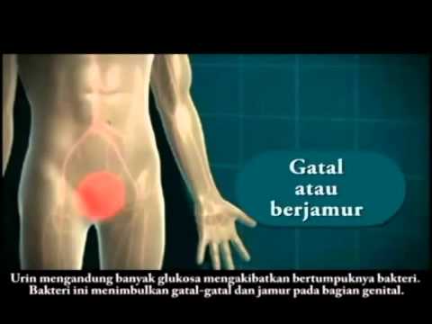 Kontrol untuk pembesaran penis Berarti merangsang manspower + lcarnitin ulasan
