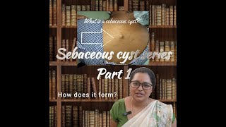 Sebaceous cyst series Part-1