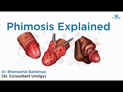 Understanding Phimosis and Balanitis: Causes, Symptoms, and Treatment Options | Dr. Bhanwarlal