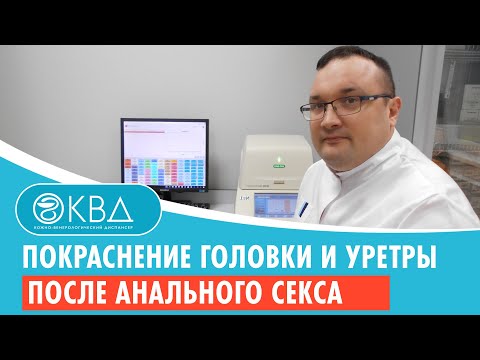 Покраснение головки и уретры после анального секса. Клинический случай №95