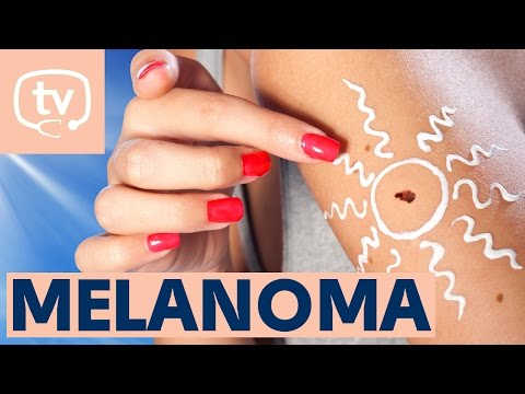El melanoma
