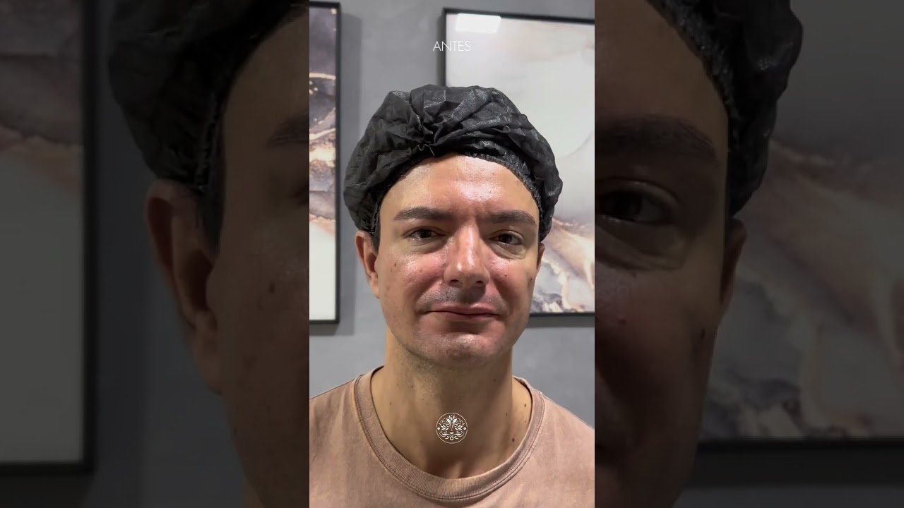 Rejuvenescimento
