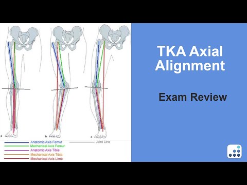 TKA Axial Alignment Exam Review - Douglas Dennis