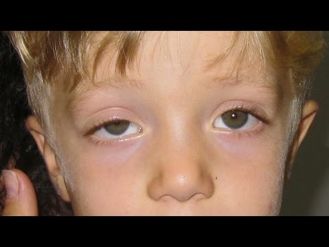 Maschere sotto occhi da rughe da un aloe Il dispositivo che si solleva per occhi