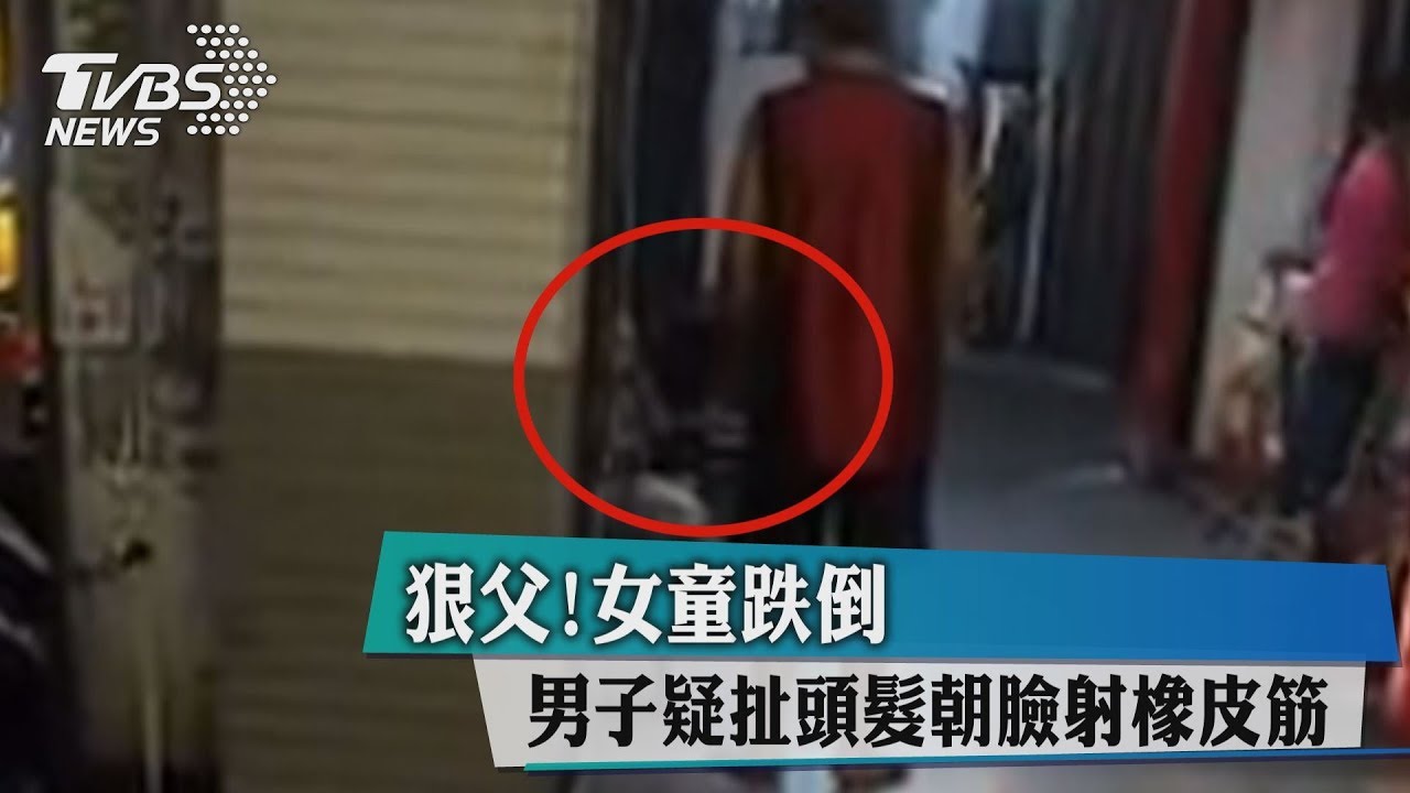 狠父!女童跌倒 男子疑扯頭髮、朝臉射橡皮筋