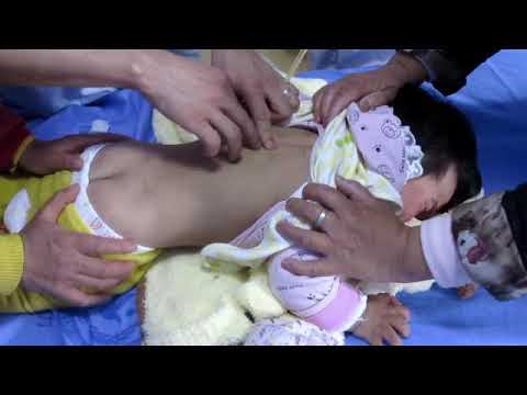 Watch lagu Images Videos Cerebral Palsy World Health Organization, Watch Images Cerebral Palsy World Health Organization free Watchn, video klip Cerebral Palsy World Health Organization
