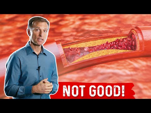 Adrenal Fatigue Is Cortisol Responsible for Your Diabetes Dr Berg