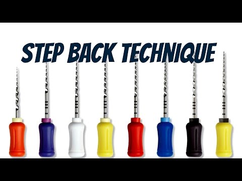 Endodontic Treatment (Step Back Technique)