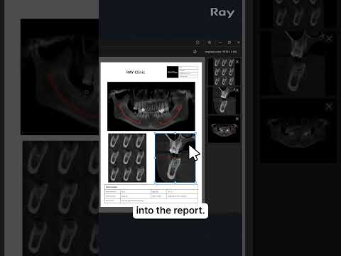 SMARTDent : 5D Tutorial #1-6. Create a Report