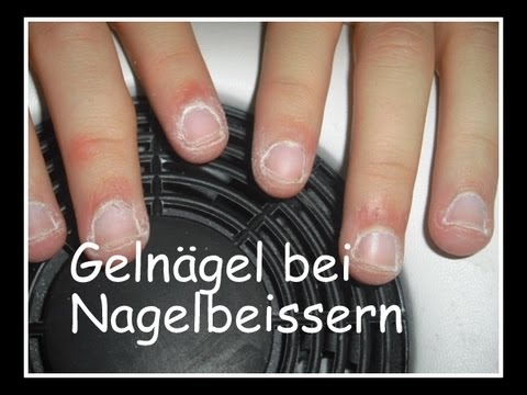 Wie weiblich sexuell gribok behandelt Als gribok zwischen der Nägel zu behandeln