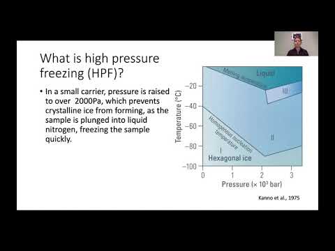 High-Pressure Freezing Preparation of Biological Samples for EM Applications