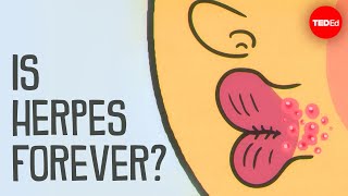 What causes herpes, and how can you treat it? - Christine Johnston
