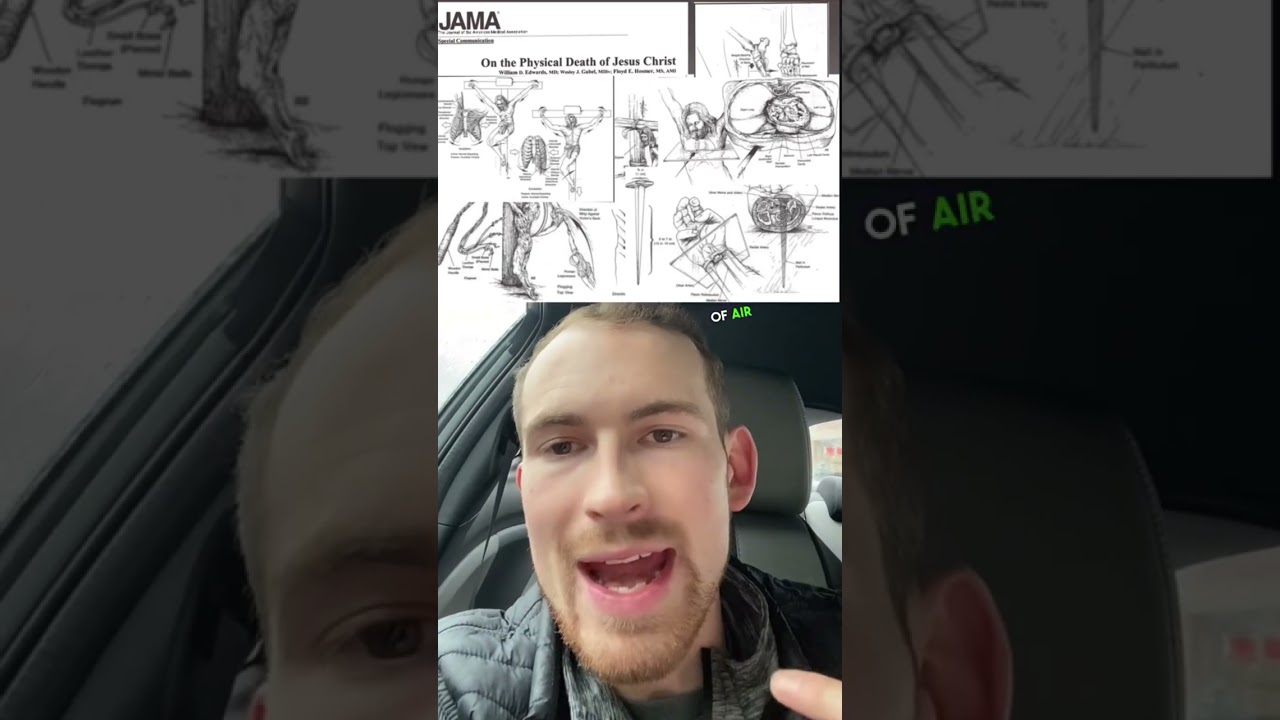 How PAINFUL! This is what Jesus went through 🤯