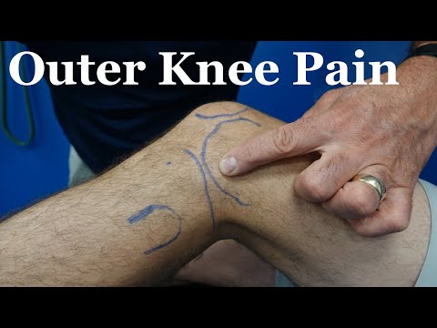 Most Common Causes of Lateral Knee Pain