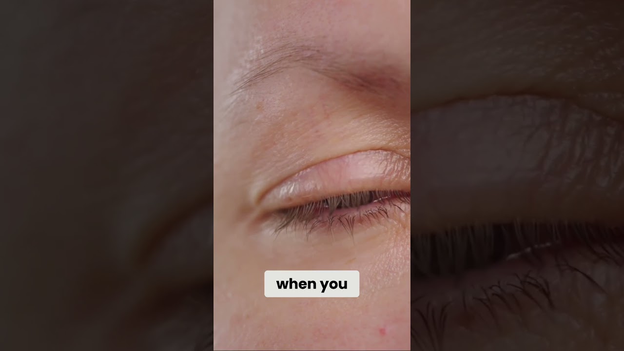 Intermittent Fasting for Dry Eye Relief!?