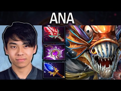 Slark Dota 2 Gameplay Ana with 22 Kills - Nullifier