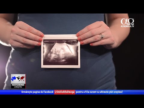 Campania pro-viață la Alfa Omega TV | Reportaj Alfa Omega TV