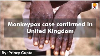 Monkeypox case confirmed in UK | What is Monkeypox ?