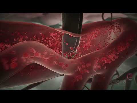 Malaria 3D Animation Shows How the Infection Spreads in the Body