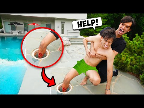 I Almost Lost My FOOT!