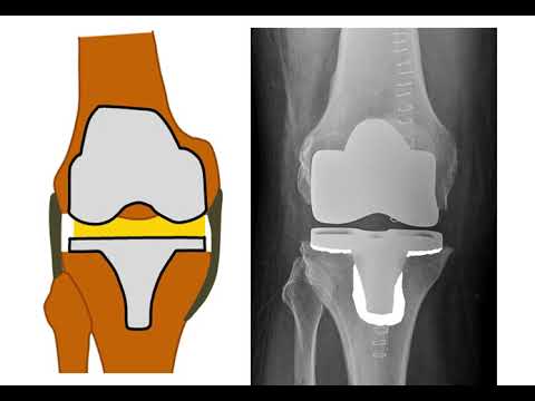 Hip and Knee Academy – Röntgen Doppelschlitten
