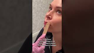 Exion Treatment NYC | Dr. Jennifer Levine