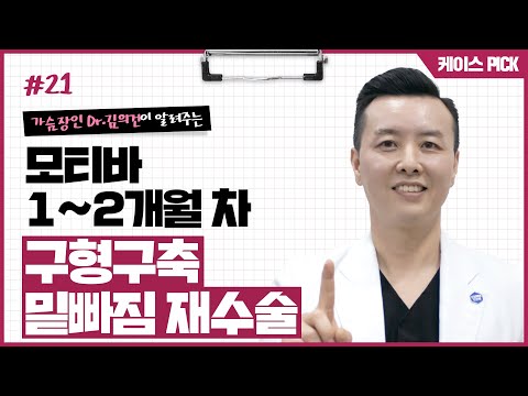 가슴재수술 I 구형구축 4단계 I 가슴 밑빠짐 I 가슴골 벌어짐 I 가슴수술 통증 I 가슴 단단함 I 재수술 후기 | 윈느성형외과 라벨윈느 유튜브 영상