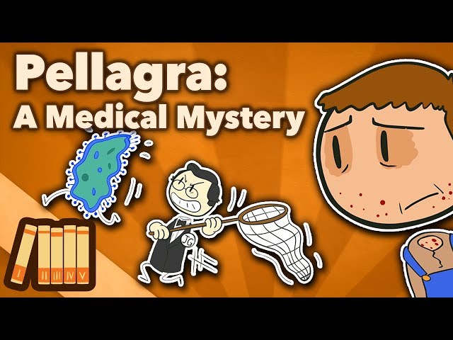 Video de pronunciación de pellagra en Inglés