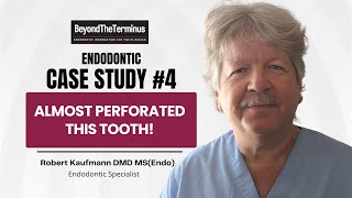 Near-Perforation Endo Case: Lessons in Accessing Through Crowns