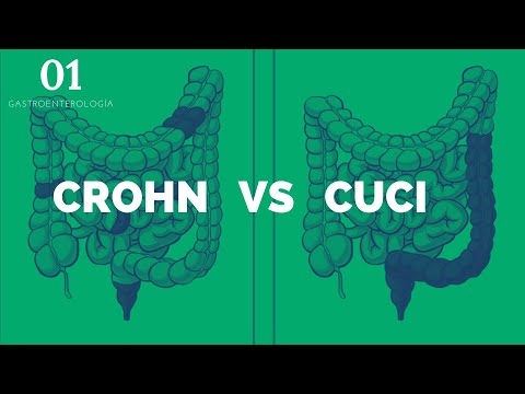 Crohn's vs. CUCI - ENARM