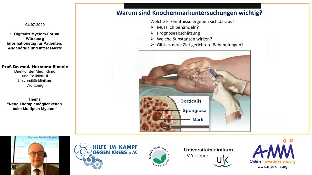 Neue Entwicklungen beim Multiplen Myelom 2020