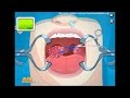 A10 Surgery Games Tonsil Surgery
