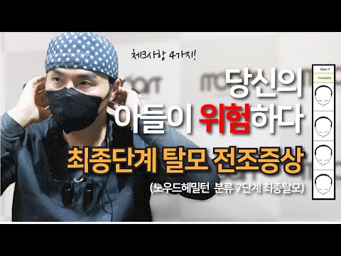 최종단계 탈모의 전조증상 | 10대 20대의 탈모 | 군인탈모