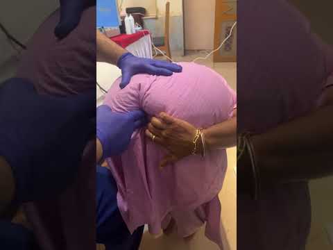 Chiropractor Treatment For Heavy Tailbone Pain #mumbai #delhi