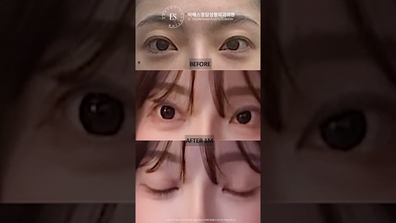 이에스 유튜브