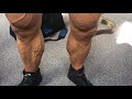 Legs 5 weeks out - Jiri Prochazka - Muscle model