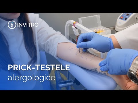 Citirea reacției alergice vizibile | 10 fapte despre prick-teste