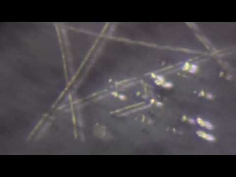 An initial evaluation of the zoom module of the Nikon smz-u for Fedir, Apple Clinic,  Lviv