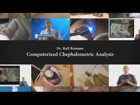 Dr. Rafi Romano- Computerized Cephalometric Analysis