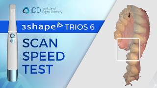 3Shape TRIOS 6 Intraoral Scanner Speed Test | iDD