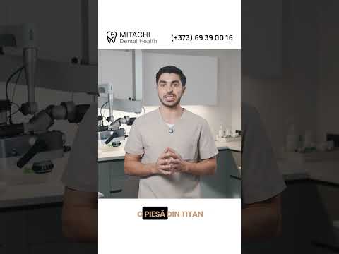 Cât timp rezistă o dantură fixă ? - Dr. Mitachi