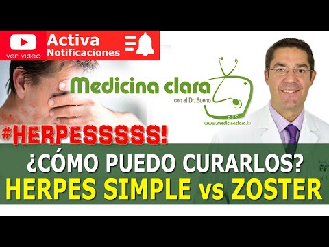 HERPES SIMPLE ⚔️ HERPES ZOSTER. ¿CÓMO SE CURAN? TRATAMIENTO HERPES| Medicina Clara