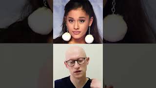 Ariana Grande New Face  Plastic Surgery Analysis
