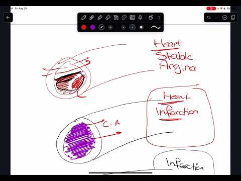 Acute coronary Syndrome (part 1)