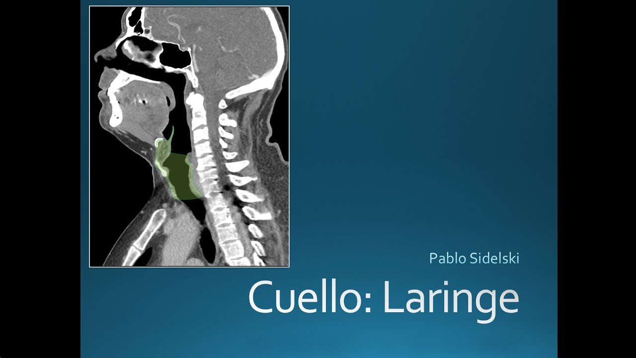 Cuello: Laringe