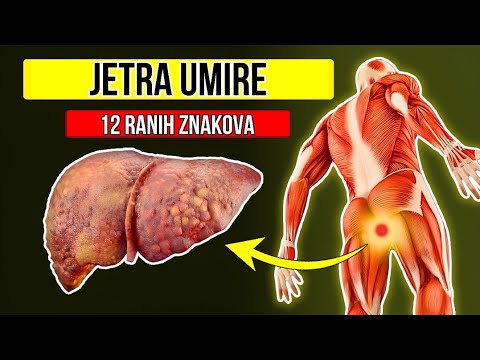 JETRA UMIRE! 12 neobičnih znakova oštećenja jetre