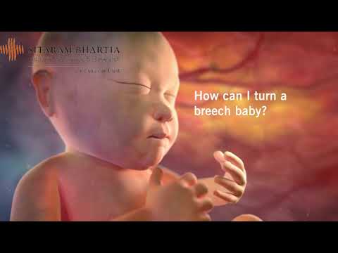 Breech Baby Turning Exercises | How to Turn Baby's Head Down Naturally