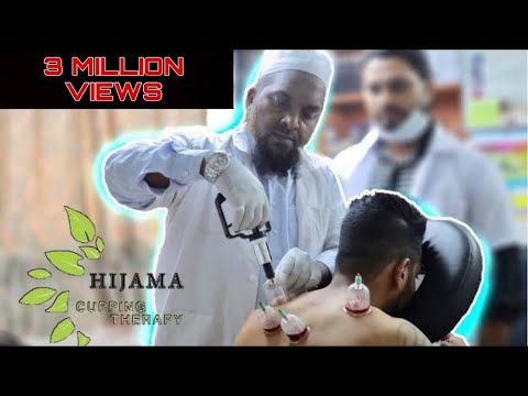 download lagu mp3 mp4 Cup Therapy In Mumbai, download lagu Cup Therapy In Mumbai gratis, unduh video klip Cup Therapy In Mumbai